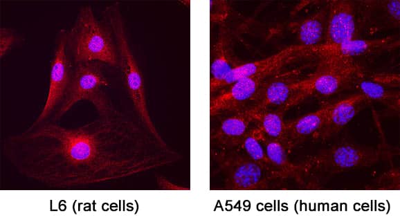 Immunocytochemistry Complexin-2 Antibody [Unconjugated]