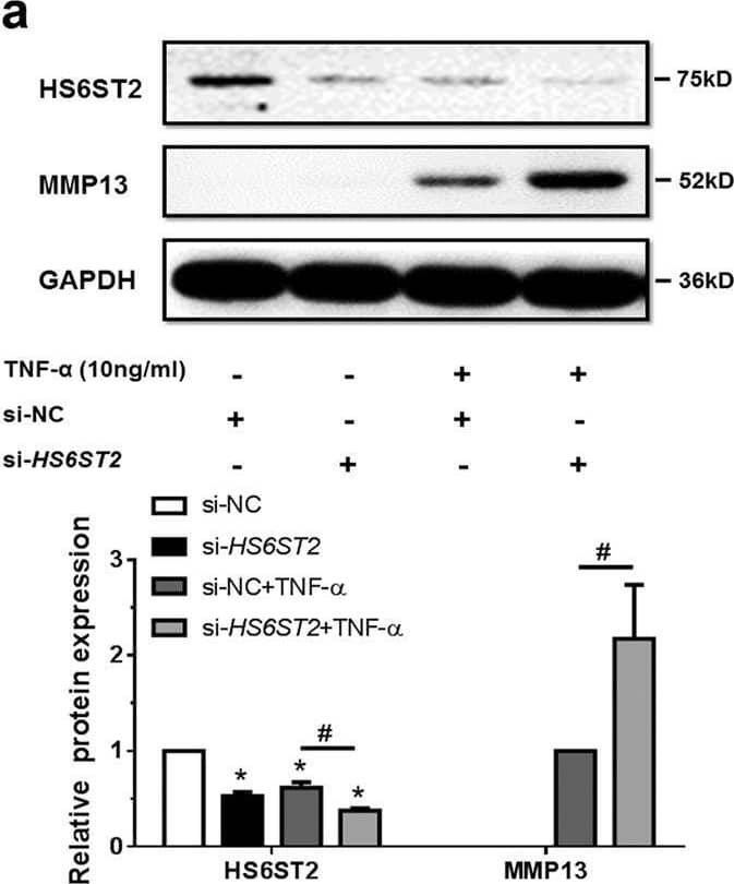 Western Blot MMP-13 Antibody [Unconjugated]