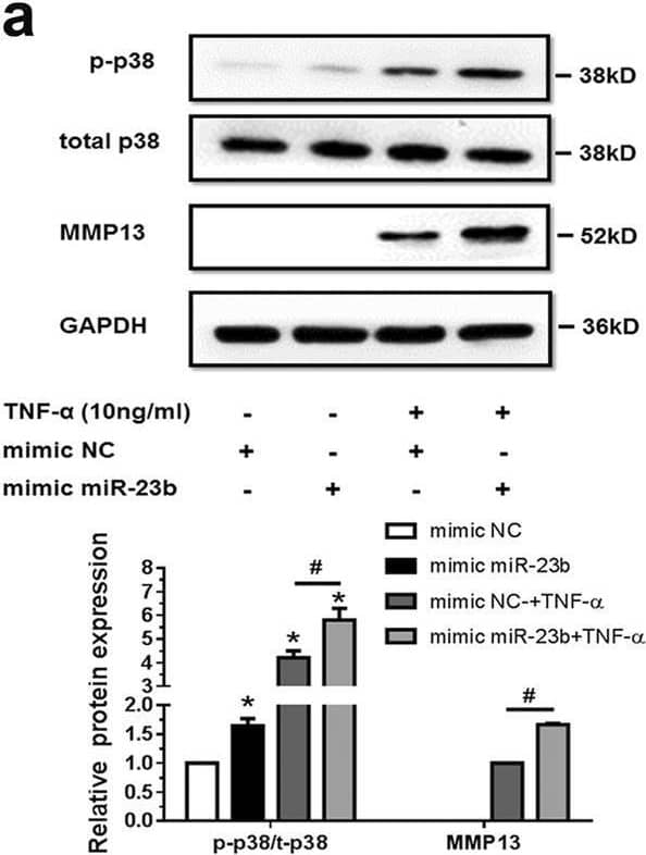 Western Blot MMP-13 Antibody [Unconjugated]
