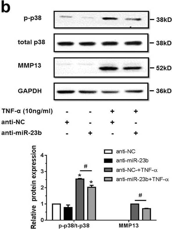 Western Blot MMP-13 Antibody [Unconjugated]