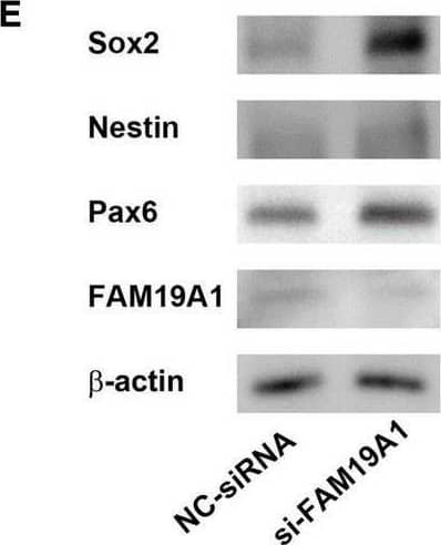 Western Blot TAFA1/FAM19A1 Antibody [Unconjugated]