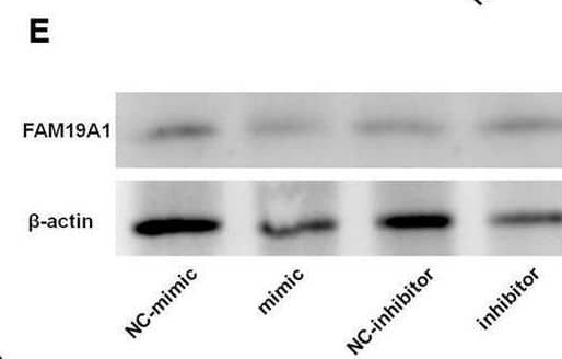 miR-582-5p down-regulates the expression of FAM19A1. (A) RNA-seq of miR-582-5p mimic and NC-mimic transfected NSCs, n = 3. (B) The mRNA expression of potential target genes in the mimic and NC-mimic group, with FAM19A1 down-regulated, n = 4. (C) RT-qPCR analysis of FAM19A1 in the inhibitor and NC-inhibitor group, n = 7. (D) RT-qPCR analysis of FAM19A1 in the GSI and control DMSO group, n = 6. (E,E’) Western blotting and statistics of FAM19A1 in the mimic/inhibitor and control group, n = 4. (F) The sequence of the FAM19A1 3′UTR and the binding site of miR-582-5p (red font). (G) The relative luciferase activity of the FAM19A1 3′UTR reporter with the increase of miR-582-5p concentration, n = 3. One-way ANOVA with Dunnett’s test. (H) The expression of firefly luciferase mRNA with the increase of miR-582-5p concentration, n = 4. One-way ANOVA with Dunnett’s test. For statistical analysis, *p < 0.05, **p < 0.01, ***p < 0.001, compared with the control, respectively. Image collected and cropped by CiteAb from the following open publication (//pubmed.ncbi.nlm.nih.gov/35685988), licensed under a CC-BY license. Not internally tested by R&D Systems.