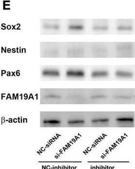 si-FAM19A1 could rescue weakened stemness and proliferation of NSCs caused by miR-582-5p inhibitor. (A) Bright field microscopy of neurospheres in the NC-inhibitor and NC-siRNA co-transfection group, the NC-inhibitor and si-FAM19A1 group, the miR-582-5p inhibitor and NC-siRNA group, and the miR-582-5p inhibitor and si-FAM19A1 group, n = 6, Scale bar = 500 μm. (B) EdU labeling of the four groups, n = 6, Scale bar = 100, 50 μm. (C) Corresponding quantifications and statistics of A and B. Two-way ANOVA with Dunnett’s test. (D) RT-qPCR of stemness markers Sox2, Nestin, Pax6, CD133, and glast, n = 3. Two-way ANOVA with Dunnett’s test. (E) Western blotting analysis of Sox2, Nestin, and Pax6, n = 5. (F) Corresponding quantifications and statistics of E. Two-way ANOVA with Dunnett’s test. For statistical analysis, *p < 0.05, **p < 0.01, ***p < 0.001, compared with the control, respectively. Image collected and cropped by CiteAb from the following open publication (//pubmed.ncbi.nlm.nih.gov/35685988), licensed under a CC-BY license. Not internally tested by R&D Systems.