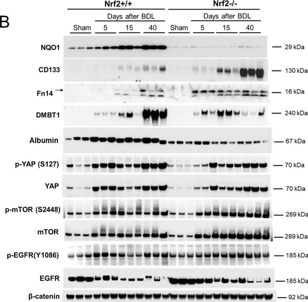 Hepatic expression of a group of genes or proteins in Nrf2+/+ and Nrf2-/- mice after bile duct ligation (BDL).(A) mRNA expression of hepatic Nrf2 and Nqo1 was quantified by qRT-PCR. (B) Western blotting was performed with antibodies against the proteins indicated. Liver lysates were prepared from the livers of mice after BDL or sham operation.  beta -catenon was used as a loading control because it showed the most stable expression over the course of cholestasis relative to regular loading controls screened. Each lane represents a sample from an individual mouse. *P < 0.05; **, P < 0.01; ***, P < 0.001. Image collected and cropped by CiteAb from the following open publication (//pubmed.ncbi.nlm.nih.gov/35696363), licensed under a CC-BY license. Not internally tested by R&D Systems.