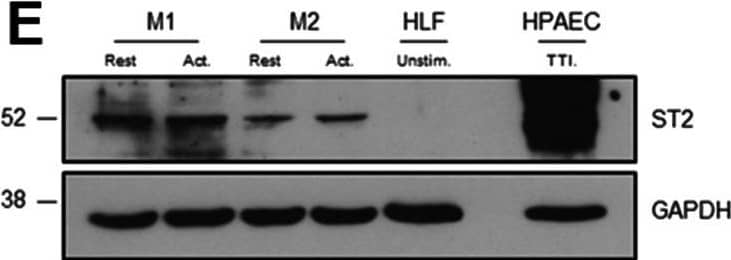 The effect of IL-33 on the pro-fibrotic activity of fibroblasts. Non-IPF (n = 2) and IPF (n = 2) HLFs were stimulated with 2 ng/ml of TGF beta  or 10 ng/ml of IL-33 for 4, 8 and 24 h and ACTA2 (A), COL1A1 (B), IL6 (C) and CXCL8 (D) gene expression measured by qPCR. For each donor, all data was normalised to the unstimulated media alone control at 4 h. Non-IPF and IPF donors are shown in black and grey respectively. Bars indicate median values and each data point represents a single donor with statistical analysis performed by Wilcoxon signed-rank test. Whole cell lysates from resting (rest.) M1 and M2 MDMs, activated (act.) M1 (IFN gamma  stimulated) and M2 (IL-4 stimulated) MDMs, HPAECs stimulated with 5 ng/ml of TNF alpha , 5 ng/ml of TGF beta  and 0.1 ng/ml of IL-1 beta  (TTI) and a single non-IPF HLF donor were separated by SDS-PAGE (20 μg protein/lane) and expression of ST2 and GAPDH measured by western blot (E). Whole cell lysates from HUVECs, non-IPF (n = 3) and IPF (n = 4) HLFs were separated by SDS-PAGE (20 μg protein/lane) and the expression of ST2 and GAPDH determined by western blot (F). Representative cropped western blots are shown Image collected and cropped by CiteAb from the following open publication (//pubmed.ncbi.nlm.nih.gov/36949463), licensed under a CC-BY license. Not internally tested by R&D Systems.