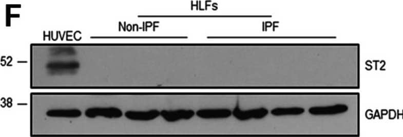 The effect of IL-33 on the pro-fibrotic activity of fibroblasts. Non-IPF (n = 2) and IPF (n = 2) HLFs were stimulated with 2 ng/ml of TGF beta  or 10 ng/ml of IL-33 for 4, 8 and 24 h and ACTA2 (A), COL1A1 (B), IL6 (C) and CXCL8 (D) gene expression measured by qPCR. For each donor, all data was normalised to the unstimulated media alone control at 4 h. Non-IPF and IPF donors are shown in black and grey respectively. Bars indicate median values and each data point represents a single donor with statistical analysis performed by Wilcoxon signed-rank test. Whole cell lysates from resting (rest.) M1 and M2 MDMs, activated (act.) M1 (IFN gamma  stimulated) and M2 (IL-4 stimulated) MDMs, HPAECs stimulated with 5 ng/ml of TNF alpha , 5 ng/ml of TGF beta  and 0.1 ng/ml of IL-1 beta  (TTI) and a single non-IPF HLF donor were separated by SDS-PAGE (20 μg protein/lane) and expression of ST2 and GAPDH measured by western blot (E). Whole cell lysates from HUVECs, non-IPF (n = 3) and IPF (n = 4) HLFs were separated by SDS-PAGE (20 μg protein/lane) and the expression of ST2 and GAPDH determined by western blot (F). Representative cropped western blots are shown Image collected and cropped by CiteAb from the following open publication (//pubmed.ncbi.nlm.nih.gov/36949463), licensed under a CC-BY license. Not internally tested by R&D Systems.
