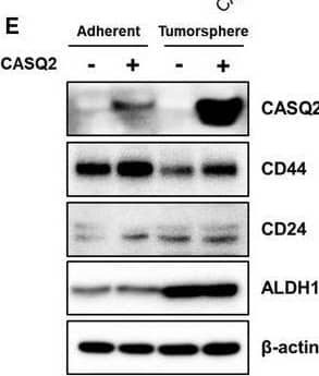CASQ2 induces phenotypic changes in breast cancer cells. (A) Relationship between the proliferation rate and overexpression of CASQ2 in breast cancer cell lines (mean ± SEM, n = 3; *P < 0.05, **P < 0.01, and ***P < 0.001 using the multiple t‐test). (B) Migration and invasion rates of Hs578T cells (mean ± SEM, n = 3; **P < 0.01 using two‐tailed Student’s t‐test). Scale bar = 50 μm. (C) Three‐dimensional culture of Hs578T cells (mean ± SEM, n = 3; **P < 0.01 using two‐tailed Student’s t‐test). Scale bar = 100 μm. (D) Tumorsphere culture of Hs578T cells (mean ± SEM, n = 3; **P < 0.01 using two‐tailed Student’s t‐test). Scale bar = 100 μm. (E) Expression of CD44, CD24, and ALDH1 cancer stem cell markers in adherent and tumorsphere cultures of Hs578T cells. (F) Measurement of intracellular Ca2+ in Hs578T cells using a calcium crimson reagent. Cells were loaded with the calcium indicator calcium crimson (5 μm) for 30 min, and then, BAPTA‐AM (10 μm) was added. After washing, the cells were stimulated by treatment with 5 μm caffeine to measure the intracellular calcium concentration at 360 s (mean ± SEM, n = 3; *P < 0.05 and **P < 0.01 after ANOVA with Tukey’s post hoc test). (G) Effect of lacidipine on the expression of cancer stem cell markers in tumorspheres of breast cancer cells. The figure shows one of three independent experiments. Statistical test result is shown in Fig. S6. (H) Epithelial–mesenchymal transition (EMT)‐related protein expression in breast cancer cells. All results are representatives of three independent experiments. Image collected and cropped by CiteAb from the following open publication (//pubmed.ncbi.nlm.nih.gov/34743414), licensed under a CC-BY license. Not internally tested by R&D Systems.