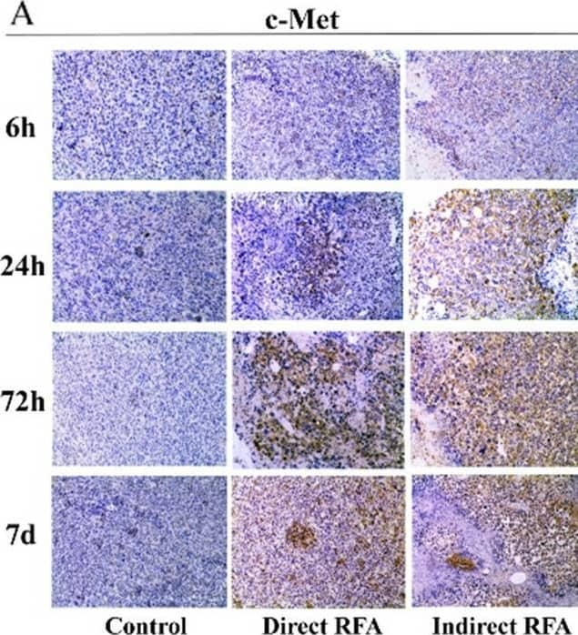 Assessment of pathologic findings obtained at 6 h, 24 h, 72 h and 7 days after treatment in different groups and the semi-quantitative analysis of c-Met (A-B), IL-6 (C-D) and HIF-alpha  (E-F). The expression of c-Met increased after RFA and reached the peak at 72 h (> 50% positive rate) in both direct RFA and indirect RFA groups. The expression of IL-6 increased after RFA in the indirect RFA group and it was significantly higher than the direct RFA group from 6 h to 72 h after treatment. The expression of HIF-alpha  was higher in the indirect RFA group than the direct RFA group from 6 h to 24 h after RFA. The bar graph showed the percentage of positive cells among the direct RFA group (blue), indirect RFA group (red) and control group (grey) at different time points after RFA. **P  50% positive rate) in both direct RFA and indirect RFA groups. The expression of IL-6 increased after RFA in the indirect RFA group and it was significantly higher than the direct RFA group from 6 h to 72 h after treatment. The expression of HIF-alpha  was higher in the indirect RFA group than the direct RFA group from 6 h to 24 h after RFA. The bar graph showed the percentage of positive cells among the direct RFA group (blue), indirect RFA group (red) and control group (grey) at different time points after RFA. **P < 0.001. The representative microphotographs were under 200 × magnification (A, C, E) Image collected and cropped by CiteAb from the following open publication (//pubmed.ncbi.nlm.nih.gov/35710408), licensed under a CC-BY license. Not internally tested by R&D Systems.