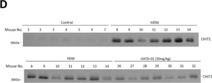 Western Blot Chitotriosidase/CHIT1 Antibody