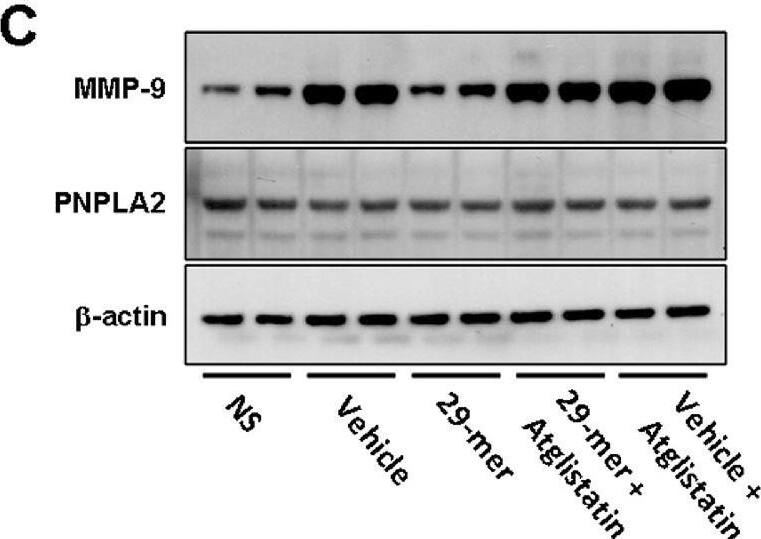 Effect of the 29-mer on the expression of MMP-9 in EDE. The schedule of induction of EDE is described in Fig. 2. (A) Representative immunofluorescence images showing MMP-9 in corneal and conjunctival epithelia after 14 days of EDE induction (n = 6 per group). (B) qPCR evaluates the levels of MMP-9 in the ocular surface epithelia (n = 6 per group). (C and D) Representative Western blots and densitometric analyses of MMP-9 and PEDF-R of ocular surface epithelia are shown from three independent experiments. Image collected and cropped by CiteAb from the following open publication (//pubmed.ncbi.nlm.nih.gov/36201200), licensed under a CC-BY license. Not internally tested by R&D Systems.