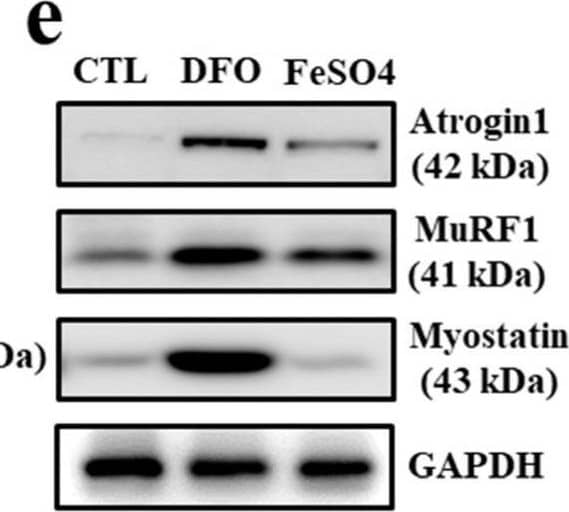 Muscle atrophy-associated gene expression under iron deficiency in myocytes. (a) mRNA expression of ferroportin, ferritin and N-Myc downstream regulated 1 (NDGR1) in C2C12 myotubes treated with deferoxamine (DFO) (100 μM/mL) and FeSO4 (400 μM /mL) for 24 h. (b) mRNA expression of myogenic and muscle atrophy-associated factors in C2C12 myotubes treated with DFO and FeSO4 for 48 h. Myf5: myogenic factor 5; MyoD: myoblast determination protein 1; MuRF1: muscle RING-finger protein-1. (c) Protein expression of ferroportin, ferritin and NDGR1 in C2C12 myotubes treated with DFO and FeSO4. GAPDH: glyceraldehyde 3-phosphate dehydrogenase. (d) Protein expression of myogenic factors in C2C12 myotubes treated with DFO and FeSO4. (e) Protein expression of muscle atrophy-associated factors in C2C12 myotubes treated with DFO and FeSO4. (f) Expression of myostatin mRNA in C2C12 myotubes treated with different doses of DFO and FeSO4. (g) Expression of myostatin mRNA in C2C12 myotubes treated with DFO in the presence or absence of FeSO4. Data represent mean ± SEM. * p < 0.05. Image collected and cropped by CiteAb from the following open publication (//pubmed.ncbi.nlm.nih.gov/36139428), licensed under a CC-BY license. Not internally tested by R&D Systems.
