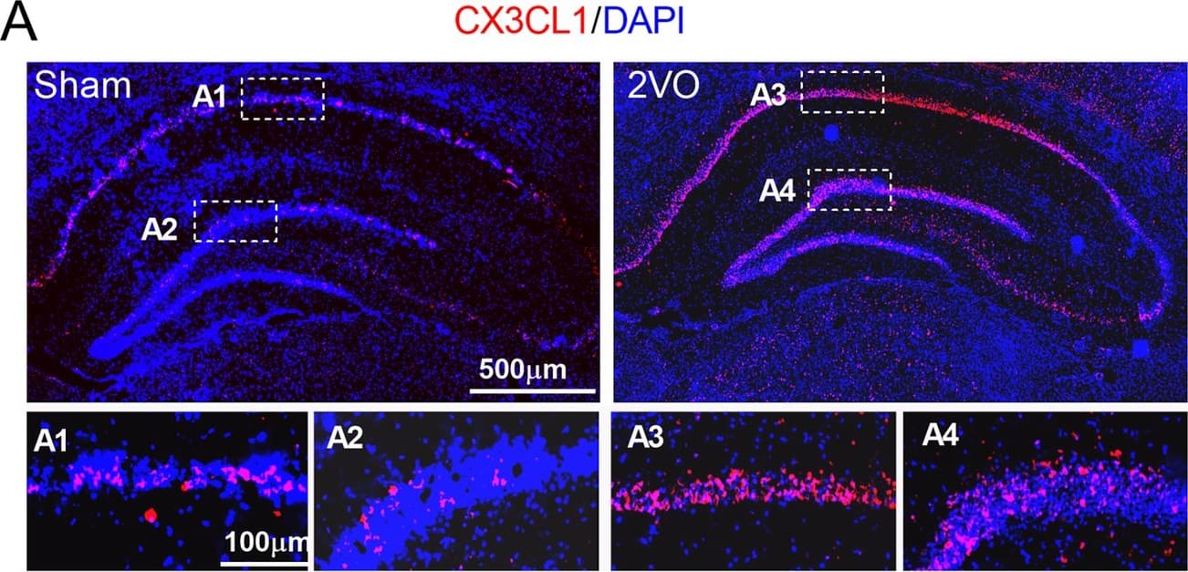 Upregulation of the expression of CX3CL1 and CX3CR1 in the hippocampus of 2VO and miR-195 loss-of-function rats. a, b Expression of CX3CL1 (red) and CX3CR1 (green) in the hippocampus of sham and 2VO rats was shown by immunofluorescence staining. The scale bar is 500 um. c Expression of CX3CL1 and CX3CR1 in the hippocampus of sham and 2VO rats detected by western blot technique. Bars represent the mean ± SD, n = 6, *P < 0.05 vs sham group, Student’s t test. d Lenti-pre-AMO-miR-195 upregulated the expression of CX3CL1 in rat hippocampus. Mean ± SD, n = 6, *P < 0.05 vs sham; #P < 0.05 vs lenti-pre-AMO-miR-195. Data were analyzed using one-way ANOVA followed by Tukey test. e Lenti-pre-AMO-miR-195 upregulated the expression of CX3CR1 in the rat hippocampus. Mean ± SD, n = 6, *P < 0.05 vs sham; #P < 0.05 vs lenti-pre-AMO-miR-195. Data were analyzed using one-way ANOVA followed by Tukey test Image collected and cropped by CiteAb from the following open publication (//pubmed.ncbi.nlm.nih.gov/32819407), licensed under a CC-BY license. Not internally tested by R&D Systems.