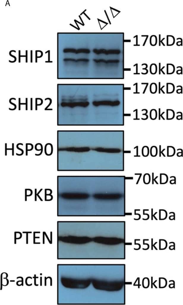 SHIP1/2 and PTEN expression is not affected in Ship2 delta / delta  mice. Neutrophils from wild-type (WT) and Ship2 delta / delta  ( delta / delta ) mice were tested for SHIP1, SHIP2, PTEN, PKB and loading control (HSP90,  beta -actin) expression. (A) Representative examples and (B–E) densitometry of 4 (PTEN, PKB, HSP90) or 5 (SHIP1/2,  beta -actin) separate experiments performed. Mean ± SEM are presented; AU, arbitrary units. n.s., not significant. (F) A comparison of blood cell counts between wild-type and Ship2 delta / delta  mice. RBC, red blood cells; WBC, white blood cells; myelo, myeloid cells; neutro, neutrophils. Every symbol represents data obtained from one mouse. p values were determined by unpaired two-tailed t tests; differences did not reach significance. Image collected and cropped by CiteAb from the following open publication (//pubmed.ncbi.nlm.nih.gov/33953730), licensed under a CC-BY license. Not internally tested by R&D Systems.