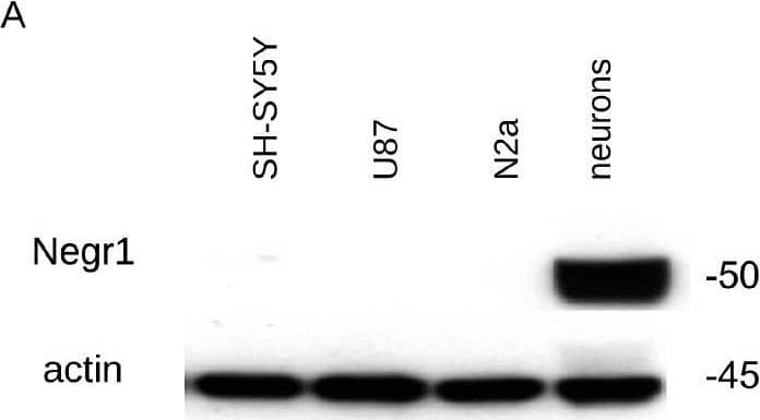 Western Blot Kilon/NEGR1 Antibody