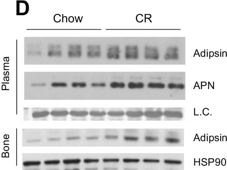 Western Blot Complement Factor D/Adipsin Antibody [Unconjugated]