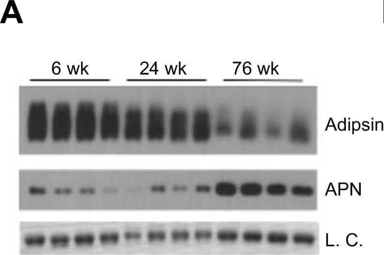 Bone marrow (BM) Adipsin induces bone marrow adiposity expansion during aging.(A) Immunoblot of Adipsin and Adiponectin from plasma of chow-fed male mice at 6, 24, and 76 weeks of age (L.C. = Coomassie staining of the membrane). (B, C) qPCR analyses of gene expression in the BM from tibia (B) and Cfd expression in the epididymal white adipose tissue and subcutaneous white adipose tissue (C) from chow-fed male mice at 26 and 78 weeks of age (n = 5, 5). *p&lt;0.05 for young vs. aging mice. (D–I) Chow-fed 1-year-old male mice. WT (n = 10) and Adipsin KO (n = 9). (D) Representative osmium tetroxide staining and (E) quantification of femoral MAT; (F, G) femoral bone mineral density (BMD) in the cortical (F) and trabecular (G) regions, and (H, I) bone volume normalized by total voume in the cortical (H) and trabecular (I) regions of the femur determined by μCT scans. **p&lt;0.01 for WT vs. Adipsin KO mice. Data represent mean ± SEM. Two-tailed Student’s t-tests were used for statistical analyses.Metabolic phenotyping of Adipsin KO mice during aging.Chow-fed 1-year-old male mice. WT (n = 10) and Adipsin KO (n = 9). (A) Body weight and composition assessed by EchoMRI; (B) insulin tolerance test; (C) GTT; (D) hematoxylin and eosin staining of femoral marrow adipose tissue. (E, F) Average trabecular number (E) and cortical thickness (F) of femurs determined by μCT scans. Data represent mean ± SEM. Two-tailed Student’s t-test was used for statistical analyses. Image collected and cropped by CiteAb from the following open publication (https://pubmed.ncbi.nlm.nih.gov/34155972), licensed under a CC-BY license. Not internally tested by R&amp;D Systems.