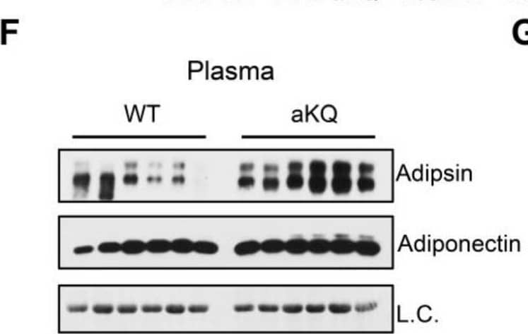 aKQ mice are sensitive to TZD treatment but with worsened BAT whitening. (A) Body compositions of diet-induced obese (DIO) WT and aKQ mice after a rosiglitazone (Rosi) diet for 7 weeks (n = 13, 9). (B). ITT on Rosi treatment for 0 and 5 weeks (n = 13, 9, 13, and 9). (C) GTT on Rosi treatment for 0 and 6 weeks (n = 13, 9, 13, and 9). (D) AUC of ITT (n = 13, 9, 13, and 9). (E) AUC of GTT (n = 13, 9, 13, and 9). (F,G) WB with quantification of Adipsin and Adiponectin protein levels in plasma (n = 6 and 6). (H) Tissue masses at sacrifice after 7 weeks of Rosi treatment (n = 13, 9). (I,J) WB with quantifications in BAT (n = 6 and 6). * p < 0.05, ** p < 0.01, *** p < 0.001. Image collected and cropped by CiteAb from the following open publication (//pubmed.ncbi.nlm.nih.gov/37408258), licensed under a CC-BY license. Not internally tested by R&D Systems.