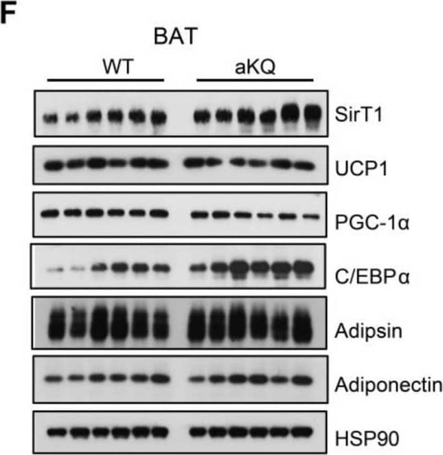 PPAR gamma  acetylation-induced BAT whitening persists despite resveratrol treatment. (A) Body-weight curves of DIO mice co-treated with Rosi and resveratrol (n = 6, 6). (B) ITT and AUC after the co-treatment for 2 weeks (n = 6, 6). (C) GTT and AUC at 3 weeks co-treatment (n = 6, 6). (D). Representative H & E staining of BAT, iWAT, and eWAT after Rosi and resveratrol treatment for 3 weeks. Scale bar: 200 µm. (n = 6, 6). (E) Quantification of WAT adipocyte size (n = 6, 6). (F,G) WB and quantifications in BAT (n = 6, 6). (H,I) Immunohistochemical staining and quantification of UCP1 protein in BAT (n = 3, 3). Data ae presented as mean ± SEM, two-tailed Student’s t-test. * p < 0.05, ** p < 0.01. Image collected and cropped by CiteAb from the following open publication (//pubmed.ncbi.nlm.nih.gov/37408258), licensed under a CC-BY license. Not internally tested by R&D Systems.