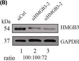 In vitro functional validation of the HMGB3. (A). The relative expression of HMGB3 in GEPIA. (B). Knockdown efficiency of HMGB3 by two small interferon RNA transfection. (C). Proliferative effect of HMGB3 on Ishikawa evaluated by Cell Counting Kit‐8 tests. (D). Effects of HMGB3 on the invasion of Ishikawa cells evaluated by Transwell assays. (E). Statistical analysis of the Transwell invasion. (F) Effects of MMP12 on the migration of Ishikawa cells evaluated by gap closure assays. (G) Statistical analysis of the gap closure. *p < 0.05, **p < 0.01. Image collected and cropped by CiteAb from the following open publication (//pubmed.ncbi.nlm.nih.gov/35778922), licensed under a CC-BY license. Not internally tested by R&D Systems.