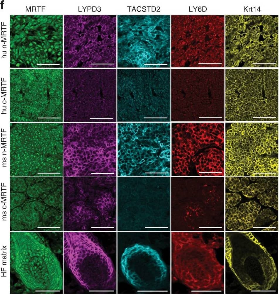 Immunohistochemistry C4.4A/LYPD3 Antibody