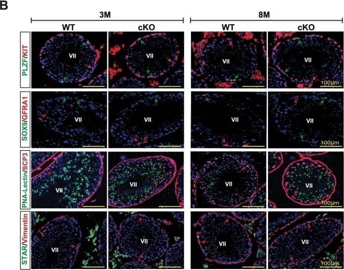 Spermatogenesis development of adult Mafb-cKO mice.Six-week-old mice were injected with tamoxifen and testes of cKO mice at 3- and 8-months of age were examined compared to those of age-matched controls (n = 4 for each group). (A) Testicular sections stained with Periodic acid-Schiff (PAS). (B) Immunostaining with various testicular cell types; undifferentiated spermatogonia (GFRA1 and PLZF), differentiated spermatogonia (KIT+ inside the tubule), spermatocytes (SCP3), spermatids (PNA-Lectin), Sertoli cells (SOX9 and Vimentin), and Leydig cells (KIT+ outside the tubule and STAR). The color of markers is indicated in the left boxes in panels. Colored arrows corresponding to the boxed markers are shown. (C) The expression level of the genes involved in testis function and germ cell development. The marker genes representing undifferentiated spermatogonia (Nanos3), differentiated spermatogonia (c-Kit), undifferentiated and differentiated spermatogonia (Sohlh1), differentiated spermatogonia and preleptotene spermatocytes (Stra8), spermatids (Prm2), Leydig cells (Hsd3b1), and Sertoli cells (Sox9) were analyzed by qRT-PCR. Each reaction was performed in duplicate for each gene. The data represent the means±SEM and are shown as relative mRNA expression after normalization to Hprt. *P<0.05. (D) The proportion of seminiferous stages: I-III, IV-VI, VII-VIII, and IX-XII from each genotype. *P<0.05. M; Month. Image collected and cropped by CiteAb from the following open publication (//dx.plos.org/10.1371/journal.pone.0190800), licensed under a CC-BY license. Not internally tested by R&D Systems.