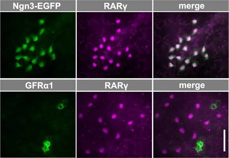 Expression of genes in the RA signaling pathway and the specificity of RAR gamma  expression by NGN3+ spermatogonia. (A) Scatter plot comparing the levels of transcripts expressed by GFR alpha 1+ and NGN3+ cells according to microarray analysis. For each fraction, average values from three independent RNA samples sorted from different animals are shown. The middle line indicates a difference of 0, and the outer lines represent ratios {log2([NGN3+]/[GFR alpha 1+])} of 1.0 and −1.0. Red dots indicate genes expressed at significantly different levels (P<0.05, t-test with Benjamini–Hochberg correction). Members of the Rar and Rxr gene families are indicated. A list of the genes in this panel is shown in supplementary material Table S2. (B) qRT-PCR analysis of Rara and Rarg mRNA expression in GFR alpha 1+, NGN3+ and KIT+ spermatogonia. Relative copy numbers are shown in arbitrary units after normalization to the amount of Actb mRNA. The mean±s.e.m. values of three independent cell preparations from different animals are shown. *P=0.043, **P=0.011 and ***P=0.0065 (t-test). (C) Representative IF images of whole-mount seminiferous tubules from Ngn3-EGFP mice stained for EGFP, GFR alpha 1 and RAR gamma . (D,E) Frequency of single- and double-positive spermatogonia for the expression of RAR gamma  and NGN3 (recognized as RAR gamma +/KIT− and NGN3-EGFP+/KIT−, respectively) (D) and of RAR gamma  and GFR alpha 1 (E). Total counts are shown above each bar. Scale bar: 50 μm. Image collected and cropped by CiteAb from the following open publication (//journals.biologists.com/dev/article/doi/10.1242/dev.118695/258623/Hierarchical-differentiation-competence-in), licensed under a CC-BY license. Not internally tested by R&D Systems.