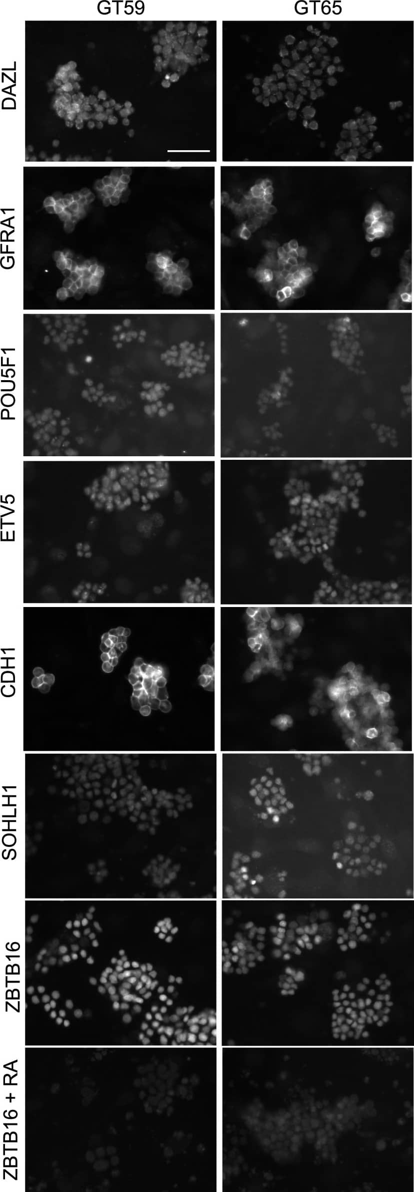 Retention of the spermatogonial phenotype following gene correction.Immunostaining was performed on gene-corrected GT59 (left) and GT65 cells (right): DAZL, a germ cell specific marker; GFRA1, POU5F1, ETV5, CDH1, and SOHLH1, markers of undifferentiated spermatogonia. Additionally, GT59 and GT65 cells were treated with the differentiation factor, retinoic acid (1 µM) or a vehicle control and then immunostained to examine levels of ZBTB16, a marker of undifferentiated spermatogonia. Bar represents 50 microns. Image collected and cropped by CiteAb from the following open publication (//pubmed.ncbi.nlm.nih.gov/25409432), licensed under a CC-BY license. Not internally tested by R&D Systems.