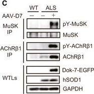 DOK7 gene therapy suppresses motor nerve terminal degeneration at the NMJ in ALS miceAForelimb grip strength of wild‐type (WT) mice&that of control&AAV‐D7 treatment groups of ALS mice at P84 (WT, n = 5 mice; control group, n = 5 mice; treatment group, n = 6 mice). Values are means ± SEM. **P = 0.0016 (WT vs. control group)&0.0003 (WT vs. treatment group) by one‐way analysis of variance (ANOVA) with Bonferroni's post hoc test. n.s., not significant.BThe difference in cycle threshold ( delta Ct) between the human SOD1‐G93A transgene&the reference mouse apob gene. To calculate the human transgene level, the  delta Ct value of hSOD1 was subtracted from the  delta Ct value of apob (control group, n = 5 mice; treatment group, n = 6 mice).C–GWT or ALS mice treated or not with 1.2 × 1012 vg of AAV‐D7 at P90 subjected to the following assays at P120. Tyrosine phosphorylation of MuSK or AChR in the hind‐limb muscle. MuSK or AChR beta 1 subunit (AChR beta 1) immunoprecipitates (IP) from whole‐tissue lysates (WTLs) of the hind‐limb muscle immunoblotted for phosphotyrosine (pY), MuSK,&AChR beta 1. WTLs blotted for Dok‐7‐EGFP, human SOD1,&GAPDH (C). Whole‐mount staining of NMJs on the diaphragm muscle. Motor nerve terminals (green)&postsynaptic AChRs (red) stained with anti‐synapsin‐1 antibodies& alpha ‐bungarotoxin, respectively. Expression of Dok‐7‐EGFP fusion protein (gray) was monitored by EGFP. Scale bars, 50 μm. NT, not treated (D). The size of AChR cluster (E), the size of motor nerve terminal (F),&innervation ratio (G) (WT‐NT, n = 5 mice; ALS‐NT, n = 5 mice; ALS‐AAV‐D7, n = 6 mice). Values are means ± SD. (E) ***P < 0.0001; (F) **P = 0.0077, ***P = 0.0001; (G) *P = 0.0134, ***P < 0.0001 by one‐way ANOVA with Dunnett's post hoc test.Source data are available online for this figure. Image collected&cropped by CiteAb from the following open publication (//pubmed.ncbi.nlm.nih.gov/28490573), licensed under a CC-BY license. Not internally tested by R&D Systems.