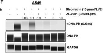 Evaluation of ZL-2201 antiproliferative activity in vitro. A, Chemical structure of ZL-2201, a potent and selective DNA-PK inhibitor. B, Concentration-dependent response to ZL-2201 in M059J and M059K glioblastoma cancer cells measured by CTG after 6-day of treatment. The graph represents the average inhibitory (IC50) values (n = 3). C, Concentration-dependent response to ZL-2201 in CRISPR KO of ATM in A549 and FaDu cancer cells measured by CTG after 6 days of treatment. The graph represents the average inhibitory (IC50) values (n = 2–5). D, IC50 responses to ZL-2201 in ATM mutant cell lines (black bars) versus ATM WT A549 cell line (gray bar). Cell growth was measured by CTG after 6 days of treatment. The graph represents the average inhibitory (IC50) values (n = 2–6). NCI-H1703 (E) and A549 (F) cancer cells were treated with bleomycin (10 μmol/L) for 2 hours followed by the addition of increasing concentration of ZL-2201 for 2 hours. Whole-cell lysates were harvested, and concentration-dependent inhibition of DNA-PK protein were analyzed by Simple Western. Image collected and cropped by CiteAb from the following open publication (//pubmed.ncbi.nlm.nih.gov/37663435), licensed under a CC-BY license. Not internally tested by R&D Systems.