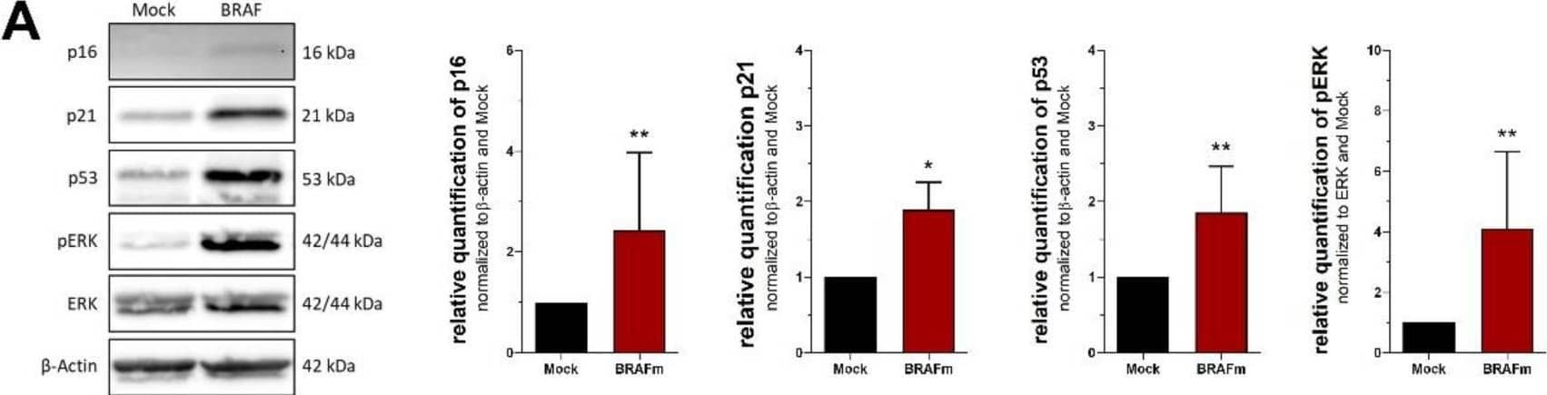 Protein markers of cellular senescence. Western blot analysis of (A) NHEM transduced with mutated BRAFV600E (all n = 7, p16 n = 6) and (B) melanoma cell line Mel Juso treated with 100 µM etoposide (n = 3). (C,D) Immunofluorescent stainings of PML and DAPI. Scale bars equal 20 µm. Bars are shown as mean ± SEM (Student’s t-test). (*: p < 0.05, **: p < 0.01, ***: p < 0.001, ****: p < 0.0001). Image collected and cropped by CiteAb from the following open publication (//pubmed.ncbi.nlm.nih.gov/35563794), licensed under a CC-BY license. Not internally tested by R&D Systems.