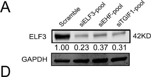 The regulatory interaction network in CRC model of LUAD-SE-associated TFs is interdependent.A–C, J Expressions of all master TFs in the knockdown of any master TF and validating the efficiency of siRNA targeting to master TFs by both real-time PCR and western blot. D–I Western blot and real-time PCR demonstrating that siRNA co-transfected with pcDNA3.1 could decrease the master TF expression significantly in both protein and mRNA level. This phenomenon could be partly reversed by either of another two master TFs, also could be reversed almost entirely in the combination of another two master TFs. K–M Data are shown as fold enrichments of master TFs promotor sub-regions in each antibody immunoprecipitate, ELF3 antibody (K), EHF antibody (L), TGIF1 antibody (M), over control IgG immunoprecipitate. GAPDH and  beta -actin were used as internal control, the lower panels showed the gray scale ratio of protein (ELF3) to GAPDH and protein (EHF and TGIF1) to  beta -actin. *p < 0.05; **p < 0.01; ***p < 0.001. Image collected and cropped by CiteAb from the following publication (//pubmed.ncbi.nlm.nih.gov/33070167), licensed under a CC-BY license. Not internally tested by R&D Systems.