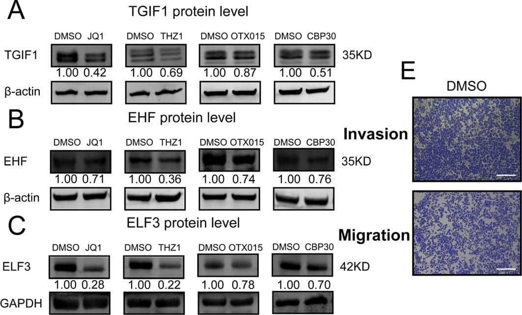 Inhibition of the SE-associated key targets attenuated LUAD malignant progression via the suppression of master TFs in CRC model.A–C Perturbation of SE associated key targets, including BRD4, EP300, and CDK7, by small-molecule inhibitors reduced the expression of master TFs significantly at protein levels. D Expressions of master TFs in LUAD cell line PC-9 treated with SE associated targets inhibitors in mRNA level were analyzed by real-time PCR. E Inhibition of invasive and migrate activity by perturbation of SE associated key targets via small molecular inhibitions. PC-9 cells were cultured with indicated small molecular inhibitions and subjected to invasion and migration assays (see “Materials and methods”). Invaded and migrated cells were stained with crystal violet and counted. Representative photographs were shown. F, G Histograms represent the number of invasion or migration cells. H In PC-9 cell lines, alterations of ELF3, EHF, and TGIF1 at protein levels while JQ1 treated for 100 nM 48 h together with or without transfected with overexpression plasmids. GAPDH and  beta -actin were used as internal control, the lower panels showed the gray scale ratio of protein (ELF3) to GAPDH and protein (EHF and TGIF1) to  beta -actin. *p < 0.05; **p < 0.01; ***p < 0.001. Image collected and cropped by CiteAb from the following publication (//pubmed.ncbi.nlm.nih.gov/33070167), licensed under a CC-BY license. Not internally tested by R&D Systems.