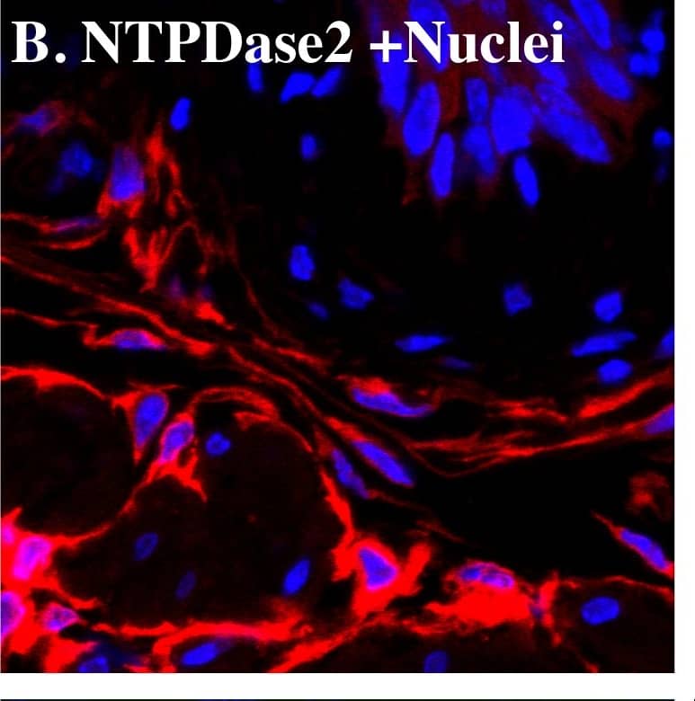 NTPDase2 co-localizes with CD34 but not tryptase in mouse bladder.Cryosections of mouse bladders were labeled with antibodies to CD34 (A, D. green), NTPDase2 (B. red), tryptase (E. red), c-kit (G. green), and Topro-3 to label nuclei (B. E. H. blue). Color merged panels are shown on the right (C, F, I). Merged signals are shown as yellow (C. F. I). White arrows indicate representative NTPDase2/CD34 co-localization (C) or CD34/tryptase co-localization (F); White asterisks indicate CD34 positive cells with no NTPDase2 staining (C). White scale bars = 10 µm. Image collected and cropped by CiteAb from the following publication (//pubmed.ncbi.nlm.nih.gov/23145014), licensed under a CC-BY license. Not internally tested by R&D Systems.