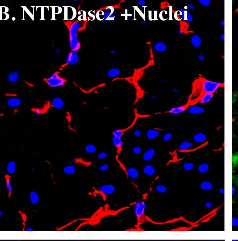 NTPDase2 immunostaining co-localize with vimentin, desmin, and PDGF beta  receptor in mice bladder.Cryosections of mouse bladders were labeled with antibodies to vimentin (A. green), desmin (D. green), PDGF beta  receptor (G. green), and NTPDase2 (B. E. H. red) and Topro-3 to label nuclei (B. blue). Color merged panels are shown on the right (C. F. I). Merged signals of NTPDase2 and vimentin, desmin, and PDGF beta  receptor are shown as yellow (C. F. I). White arrows indicate representative co-localization. White asterisks indicate non-co-localized signal of smooth muscle (I) and fibroblasts (F. I). White scale bars = 10 µm. Image collected and cropped by CiteAb from the following publication (//pubmed.ncbi.nlm.nih.gov/23145014), licensed under a CC-BY license. Not internally tested by R&D Systems.