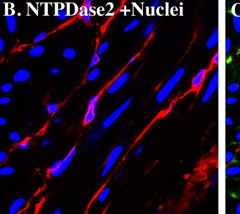 NTPDase2 immunostaining co-localize with merlin/NF2 in mice bladder.Cryosections of mouse bladders were labeled with antibodies to merlin/NF2 (A. green), NTPDase2 (B. red) and Topro-3 to label nuclei (B. blue). Color merged panels are shown on the right (C). Merged signals of NTPDase2 and merlin/NF2 are shown as yellow (C). White arrows indicate representative NTPDase2/merlin co-localization. White scale bars = 10 µm. Image collected and cropped by CiteAb from the following publication (//pubmed.ncbi.nlm.nih.gov/23145014), licensed under a CC-BY license. Not internally tested by R&D Systems.