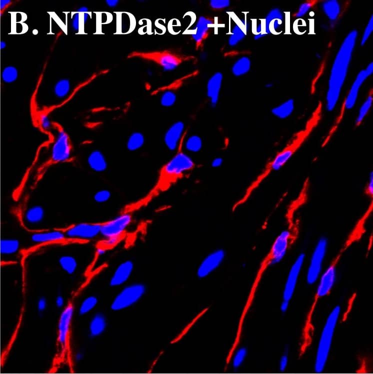 NTPDase2 immunostaining co-localize with connexin 43 in mice bladder.Cryosections of mouse bladders were labeled with antibodies to connexin 43 (A. green), NTPDase2 (B. red) and Topro-3 to label nuclei (B. blue). Color merged panels are shown on the right (C). Merged signals of NTPDase2 and connexin 43 are shown as yellow (C). White arrows indicate representative NTPDase2/connexin 43 co-localization. White scale bars = 10 µm. Image collected and cropped by CiteAb from the following publication (//pubmed.ncbi.nlm.nih.gov/23145014), licensed under a CC-BY license. Not internally tested by R&D Systems.