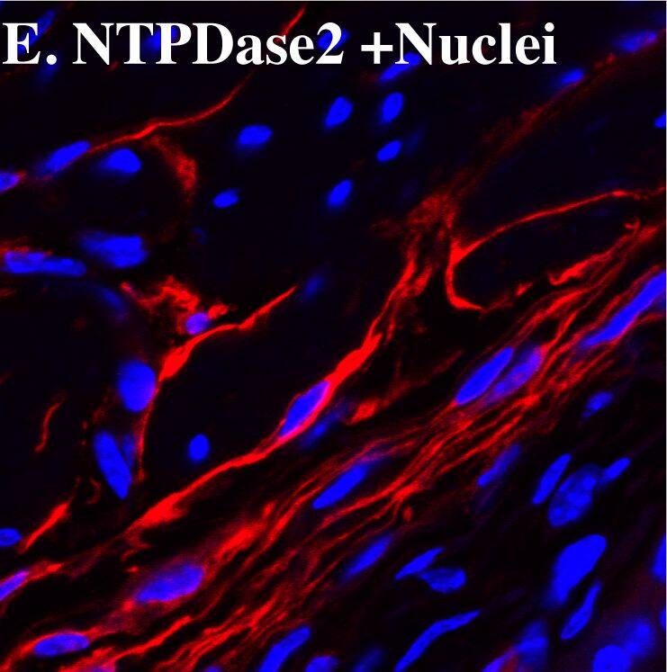 NTPDase2 immunostaining co-localize with vimentin, desmin, and PDGF beta  receptor in mice bladder.Cryosections of mouse bladders were labeled with antibodies to vimentin (A. green), desmin (D. green), PDGF beta  receptor (G. green), and NTPDase2 (B. E. H. red) and Topro-3 to label nuclei (B. blue). Color merged panels are shown on the right (C. F. I). Merged signals of NTPDase2 and vimentin, desmin, and PDGF beta  receptor are shown as yellow (C. F. I). White arrows indicate representative co-localization. White asterisks indicate non-co-localized signal of smooth muscle (I) and fibroblasts (F. I). White scale bars = 10 µm. Image collected and cropped by CiteAb from the following publication (//pubmed.ncbi.nlm.nih.gov/23145014), licensed under a CC-BY license. Not internally tested by R&D Systems.