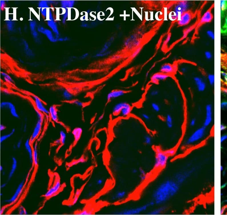 NTPDase2 immunostaining co-localize with vimentin, desmin, and PDGF beta  receptor in mice bladder.Cryosections of mouse bladders were labeled with antibodies to vimentin (A. green), desmin (D. green), PDGF beta  receptor (G. green), and NTPDase2 (B. E. H. red) and Topro-3 to label nuclei (B. blue). Color merged panels are shown on the right (C. F. I). Merged signals of NTPDase2 and vimentin, desmin, and PDGF beta  receptor are shown as yellow (C. F. I). White arrows indicate representative co-localization. White asterisks indicate non-co-localized signal of smooth muscle (I) and fibroblasts (F. I). White scale bars = 10 µm. Image collected and cropped by CiteAb from the following publication (//pubmed.ncbi.nlm.nih.gov/23145014), licensed under a CC-BY license. Not internally tested by R&D Systems.