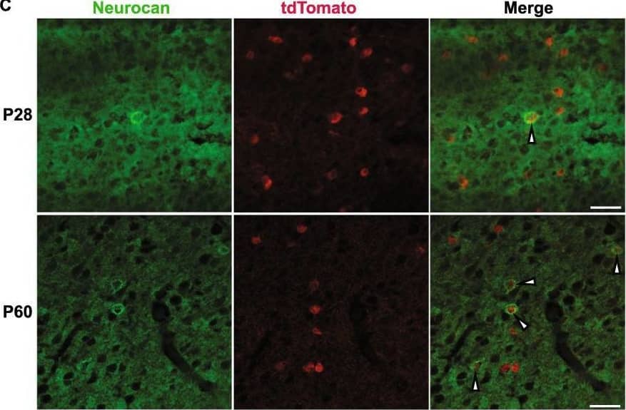 Immunohistochemistry Neurocan Antibody