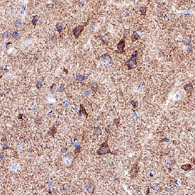 Preconditioning with HGF induces Timp1 (tissue inhibitor of metalloproteinases-1) protein synthesis, which is followed by Stat3 phosphorylation and protection against Doxo-induced apoptosis. (a) H9c2 cardiomyoblasts were treated with Doxo (25 μM) or Doxo+HGF (0.5 nM). For cell treatments, see Figure 1a. Timp1 protein levels were evaluated by Western blotting at different points of recovery time (a). Cells were also treated with (b) 500 nM JNJ38877605 Met inhibitor (Doxo+HGF+JNJ) or (c,d) 1 µM PD98059 Erk1,2 inhibitor (Doxo+HGF+PD). Protein (b,d) and mRNA (c) levels of Timp1 were analyzed after 24 h of recovery time. Polr2a was used as reference gene for the expression data normalization. *** p VC004). Before incubation with the primary antibody, tissue was subjected to heat-induced epitope retrieval using VisUCyte Antigen Retrieval Reagent-Basic (Catalog # VCTS021). Tissue was stained using DAB (brown) and counterstained with hematoxylin (blue). Specific staining was localized to neuronal cell bodies. View our protocol for IHC Staining with VisUCyte HRP Polymer Detection Reagents.