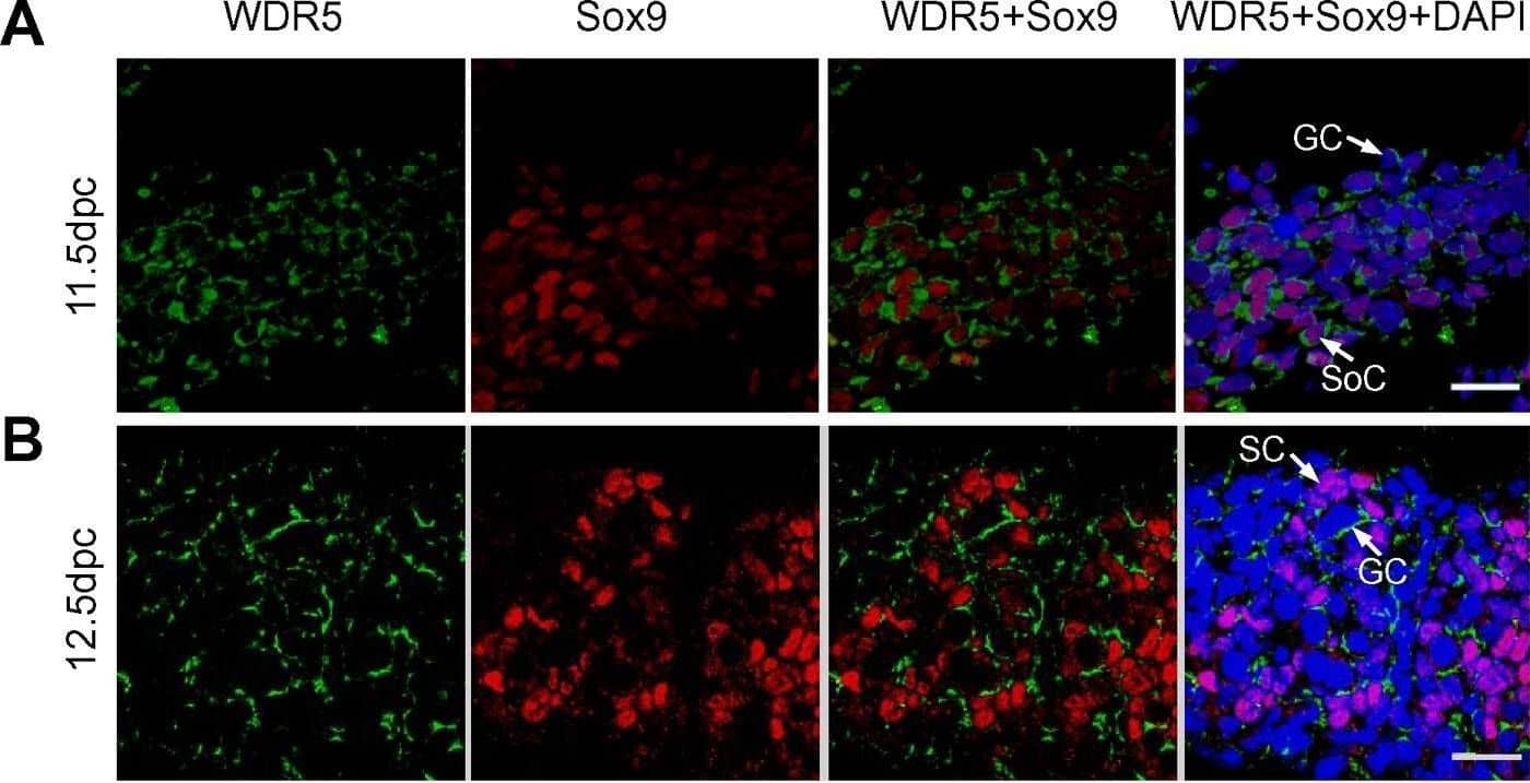 Immunolocalization of WDR5 protein and gene expression in embryonic testis.(A) Immunofluorescent staining of WDR5 (in green) and Sox9 (in red) protein in mouse E11.5 testis. Soc, Somatic cells; GC, Germ cells. Scale bar, 20 µM. (B) Immunofluorescent staining of WDR5 (in green) and Sox9 (in red) protein in mouse E12.5 testis. SC, Sertoli cells; GC, Germ cells. Scale bar, 20 µM. (C) Immunofluorescent staining of WDR5 (in green) and Sox9 (in red) protein in mouse E13.5 testis. IC, interstitial cells. Scale bar, 20 µM. Data shown are representative of three independent experiments. (D) ChIP analysis of SRY on rat WDR5 promoter and Tcf21 promoter. Graphs show mean ±SD, n = 3. **P<0.01 compared to control; Student's t-test. (E) Quantitative real time PCR analysis of WDR5, Sox9, and SRY levels relative to  beta -actin in male rat gonads at indicated embryonic stages. Image collected and cropped by CiteAb from the following open publication (//pubmed.ncbi.nlm.nih.gov/22523547), licensed under a CC-BY license. Not internally tested by R&D Systems.