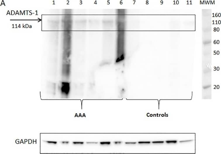 Western blot analysis.(A) Expression of ADAMTS-1 and GAPDH in human AAA aortas (sample 1–6) and human non-aneurysmal control aortas (sample 7–11) and (B) quantification of ADAMTS-1 in relative values normalized to GAPDH. MWM: molecular weight marker indicating size in kDa. Image collected and cropped by CiteAb from the following publication (//pubmed.ncbi.nlm.nih.gov/28570682), licensed under a CC-BY license. Not internally tested by R&D Systems.