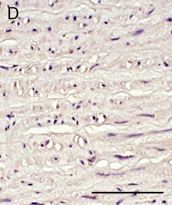 Immunohistochemical staining.(A) ADAMTS-1, (B) SMC marker  alpha -actin, (C) macrophage marker in adventitial layer of human AAA aortas and (D) ADAMTS-1 in human non-aneurysmal control aortas. Staining of positive cells are seen in brown. The images are taken with 40X magnification and scale bar represent 50 μm. Red arrow indicates the same area. Image collected and cropped by CiteAb from the following publication (//pubmed.ncbi.nlm.nih.gov/28570682), licensed under a CC-BY license. Not internally tested by R&D Systems.