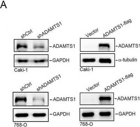 ADAMTS1 expression promotes anoikis resistance of renal cell carcinoma (RCC) via inhibiting Bid, Bim, and Bak. A A western blot analysis was conducted to assess ADAMTS1 expression in Caki-1 and 786-O cells following transduction with either ADAMTS1 short hairpin (sh)RNA (left) or an ADAMTS1-expressing vector (right). B Cell viability of suspended Caki-1 and 786-O cells was evaluated using a CCK8 assay at 24 and 48 h post-stable overexpression (right) or knockdown (left) of ADAMTS1. Data are presented as the mean ± SD of three independent experiments. * p < 0.05, compared with the control group. C Dot plot demonstrated the correlation between the single sample gene set enrichment analysis (ssGSEA) score of “negative regulation of anoikis” and ADAMTS1 expression in TCGA-KIRC patients. A Pearson correlation was performed to evaluate their association and significance. D Western blot analysis of intrinsic apoptosis-related proteins (Bad, Bcl-2, Bak, Bid, Bim, and PARP) in suspended Caki-1 cells manipulated with ADAMTS1. GAPDH served as a loading control. E and F Dissemination of RCC cells in zebrafish embryos. Caki-1 cells with ADAMTS1-knockdown were implanted into zebrafish embryos at 48 h post fertilization. Tumor cell dissemination was observed at 2 days post injection (dpi), with disseminated tumor foci indicated by white arrowheads on the trunk and end-tail (E). Integrated densities of Caki-1 metastatic tumor cells in the zebrafish trunk and end-tail at 2 dpi were quantified, with the mean value of the integrated density in the shCtl group set to onefold (F) Image collected and cropped by CiteAb from the following open publication (//pubmed.ncbi.nlm.nih.gov/39333870), licensed under a CC-BY license. Not internally tested by R&D Systems.