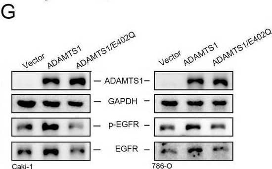 The metalloproteinase activity of ADAMTS1 is pivotal in stimulating the secretion of cleaved versican, activating the epidermal growth factor receptor (EGFR), promoting invasion, and conferring anoikis resistance in renal cell carcinoma (RCC) cells. A A schematic representation depicting two variants of the recombinant ADAMTS1 protein: one containing the metalloproteinase domain (ZnMc) and the other lacking it (TSP), along with a mutant ADAMTS1 expression construct (E402Q). B–E Treatment of Caki-1 cells with or without the recombinant ZnMc or TSP protein (40 nM) for 24 or 48 h. Subsequently, secretion of cleaved versican, activation of EGFR signal cascades, invasive abilities, and anoikis were respectively assessed using dot blot (B), western blotting (C), Matrigel invasion (D), and CCK8 assays. F–I Cleaved versican secretion (F), EGFR activation (G), invasive abilities (H), and anoikis (I) were evaluated in Caki-1 and 786-O cells after transducing wild-type (WT) ADAMTS1, ADAMTS1/E402Q, or a control vector. In D, E, H, and I, values are presented as the mean ± SD of three independent experiments. *p < 0.05, **p < 0.01, ***p < 0.001, compared with the control group; #p < 0.05, ###p < 0.001, compared with the WT ADAMTS1-overexpressing group Image collected and cropped by CiteAb from the following open publication (//pubmed.ncbi.nlm.nih.gov/39333870), licensed under a CC-BY license. Not internally tested by R&D Systems.