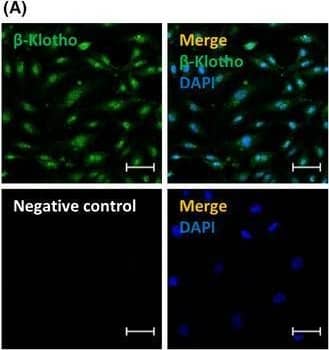 Effects of FGF21 on  beta ‐klotho expression and oxidative stress in EPCs. After FGF21 treatment, cells were (A) stained with an  beta ‐klotho antibody, and (B) protein expression was analysed by Western blotting. (C) The effects of FGF21 on EPC viability were analysed by the CCK‐8 assay. (D) EPCs were treated with the indicated concentration of FGF21 for 12 h and 600 µM H2O2 for 1 h. Intracellular ROS levels were measured using a Fluorometric Intracellular ROS Kit. The results are expressed as the mean ± SEM of five separate experiments run in triplicate (*p < 0.01 vs. control, #p < 0.01 vs. H2O2 only) Image collected and cropped by CiteAb from the following open publication (//pubmed.ncbi.nlm.nih.gov/35307922), licensed under a CC-BY license. Not internally tested by R&D Systems.