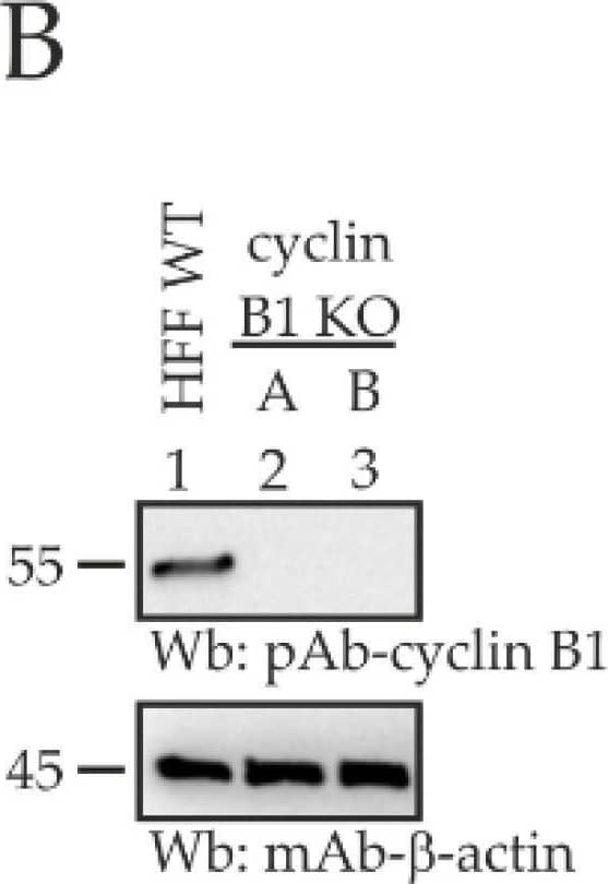 HCMV AD169-GFP replication kinetics in HFF WT and cyclin B1/T1 KO populations. HFFs were infected with HCMV AD169. Viral replication kinetics were determined by collecting viral supernatants at the indicated time points, and viral genome equivalents were determined by qPCR. Each value represents the mean ± SD of two independent biological replicates, each measured twice: (A) replication kinetics obtained for cyclin B1 KO cell populations A and B compared to WT (MOI 0.025); (C) replication kinetics obtained for cyclin T1 KO cell populations A, B and C compared to WT (MOI 0.01); (B,D) effectivity of cyclin B1 KO (cell populations A and B) and cyclin T1 KO (cell populations A, B and C), respectively, was verified by standard SDS-PAGE and Wb analysis using specific antibodies as indicated. Image collected and cropped by CiteAb from the following open publication (//pubmed.ncbi.nlm.nih.gov/36233116), licensed under a CC-BY license. Not internally tested by R&D Systems.