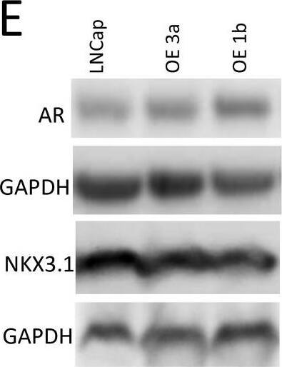 Activation of  beta -catenin pathway in LNCaP cells overexpressing δ-catenin(A) Comparison of levels of δ-catenin in overexpressing LNCaP clones and other PCa cell lines. Full length protein is depicted by arrow. (B) Levels of catenin proteins in δ-catenin overexpressing LNCaP clone (designated as OE1b) are shown. Gradient loading of total protein for OE1b clone was used to illustrate an increase in expression of each protein (right panel). Quantification graphs showing protein levels normalized to GAPDH level (arbitrary units, a.u.) are at the bottom. (C) Characterization of nuclear (NE) and cytoplasmic (CE) levels of  beta -catenin. Nuclear and cytoplasmic protein was isolated,  beta -catenin was detected by Western blotting using specific antibody. TBP and GAPDH were used as loading control of nuclear and cytoplasmic protein respectively. Normalized level of  beta -catenin in each compartment is shown at the bottom. (D and E) Characterization of levels of proteins, downstream targets of Wnt/ beta -catenin pathway (D), and androgen regulated genes AR and NKX3.1 (E) by Western blotting. Corresponding quantification is shown. Three clones (OE3a, OR1b, OE1c) overexpressing δ-catenin at various levels were examined. Total amount of 30ug of protein was used in each experiment, unless otherwise specified (in B). SDS-PAGE and Western blot conditions as in Figure 2. Image collected and cropped by CiteAb from the following publication (//pubmed.ncbi.nlm.nih.gov/29849951), licensed under a CC-BY license. Not internally tested by R&D Systems.