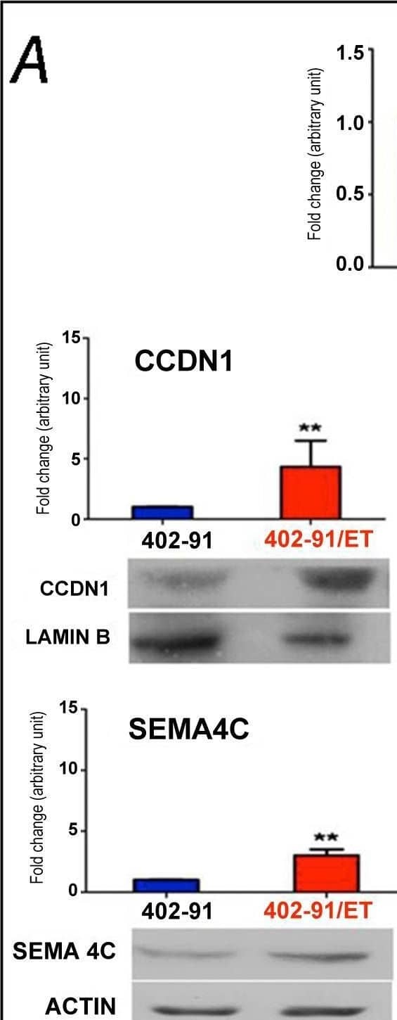 Signature validation of miRNA-mRNA and proteins found differentially expressed between 402-91/ET and 402-91 cell line. Panel A. qRT-PCR and Western blot analysis showing differences in the expression levels of let-7e and its downstream targets (CCDN1, E2F5, SEMA4C, HMGA1 and HMGA2). Panel B. qRT-PCR and Western blot for miR-21 and its downstream target, PDCD4. qRT-PCR data are the mean of three independent experiments performed in triplicate and calculated with the 2− delta  delta Ct method as described in the material and method section. The control 402-91 cells values are arbitrarily set as 1. Bars are +/− SD. * is significant with p<0.05, ** p<0.01, ***p<0.001, as assessed with Student T-test. Western blot is representative of at least two independent experiments. Image collected and cropped by CiteAb from the following open publication (//pubmed.ncbi.nlm.nih.gov/22523595), licensed under a CC-BY license. Not internally tested by R&D Systems.