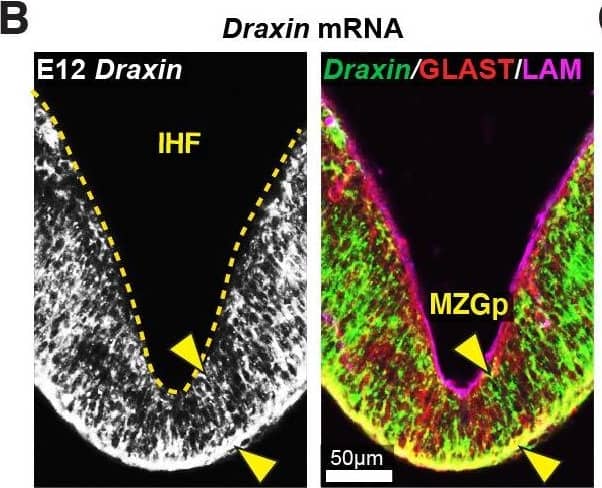 Draxin is expressed in midline zipper glia (MZG) and their progenitors, and associates with MZG membranes, leptomeninges, and the pial surface of the interhemispheric fissure (IHF).Schema of interhemispheric midline at E12 (A), E15 (D dorsal; G ventral) and E17 (I). In situ hybridisation for Draxin mRNA (white or green), with immunohistochemistry for astroglial marker, GLAST (red), and leptomeninges and IHF marker, Laminin (LAM; magenta) in E12 (B), E15 (E), and E17 (J) wildtype CD1 mid-horizontal telencephalic midline tissue sections. Yellow arrowheads indicate Draxin-positive/GLAST-positive glia. Open red arrowheads indicate lack of Draxin mRNA within the IHF (yellow outlined). Immunohistochemistry for DRAXIN (white or green), GLAST (red or magenta), and LAM (magenta) in E12 (C), E15 (F), and E17 (K) wildtype CD1 mid-horizontal telencephalic midline tissue sections. (H) DRAXIN (white or green), axonal marker GAP43 (red), and LAM (magenta) in E15 ventral telencephalic midline tissue sections. Yellow arrowheads indicate regions of DRAXIN protein on GLAST-positive glial fibres (C, F, K) or DRAXIN protein on GAP43-positive axons (H’). White arrowheads indicate DRAXIN protein within the IHF and on the basement membrane of the IHF. BM: basement membrane; CCx: cingulate cortex; IGG: indusium griseum glia; LM: leptomeninges; MZGp: midline zipper glia progenitors; Se: septum; Th: telencephalic hinge; 3V: third ventricle. Image collected and cropped by CiteAb from the following open publication (//pubmed.ncbi.nlm.nih.gov/33945466), licensed under a CC-BY license. Not internally tested by R&D Systems.